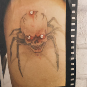 Dermals