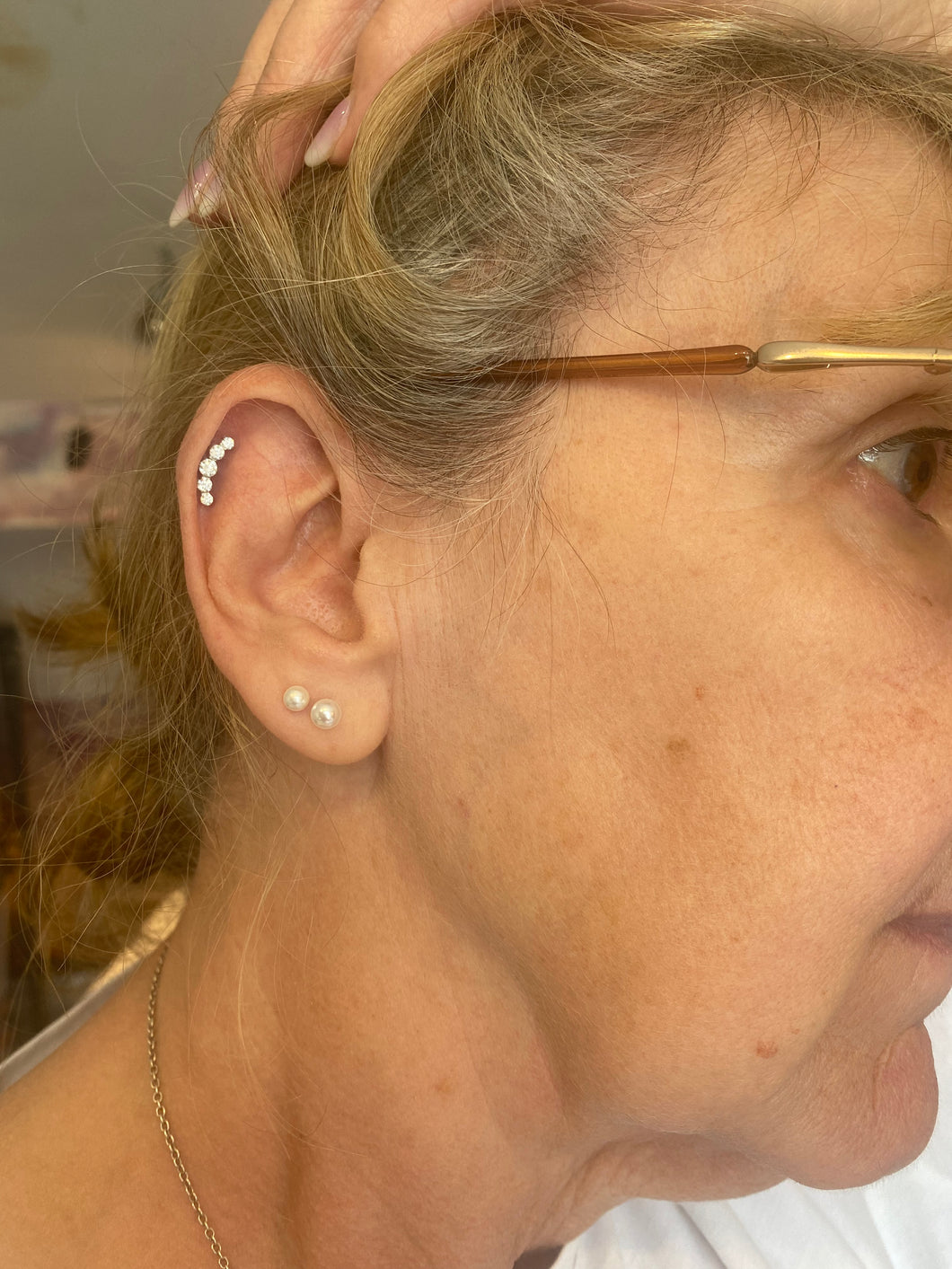 Top ear