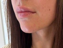 Load image into Gallery viewer, Lip filler ( natural looking lips)
