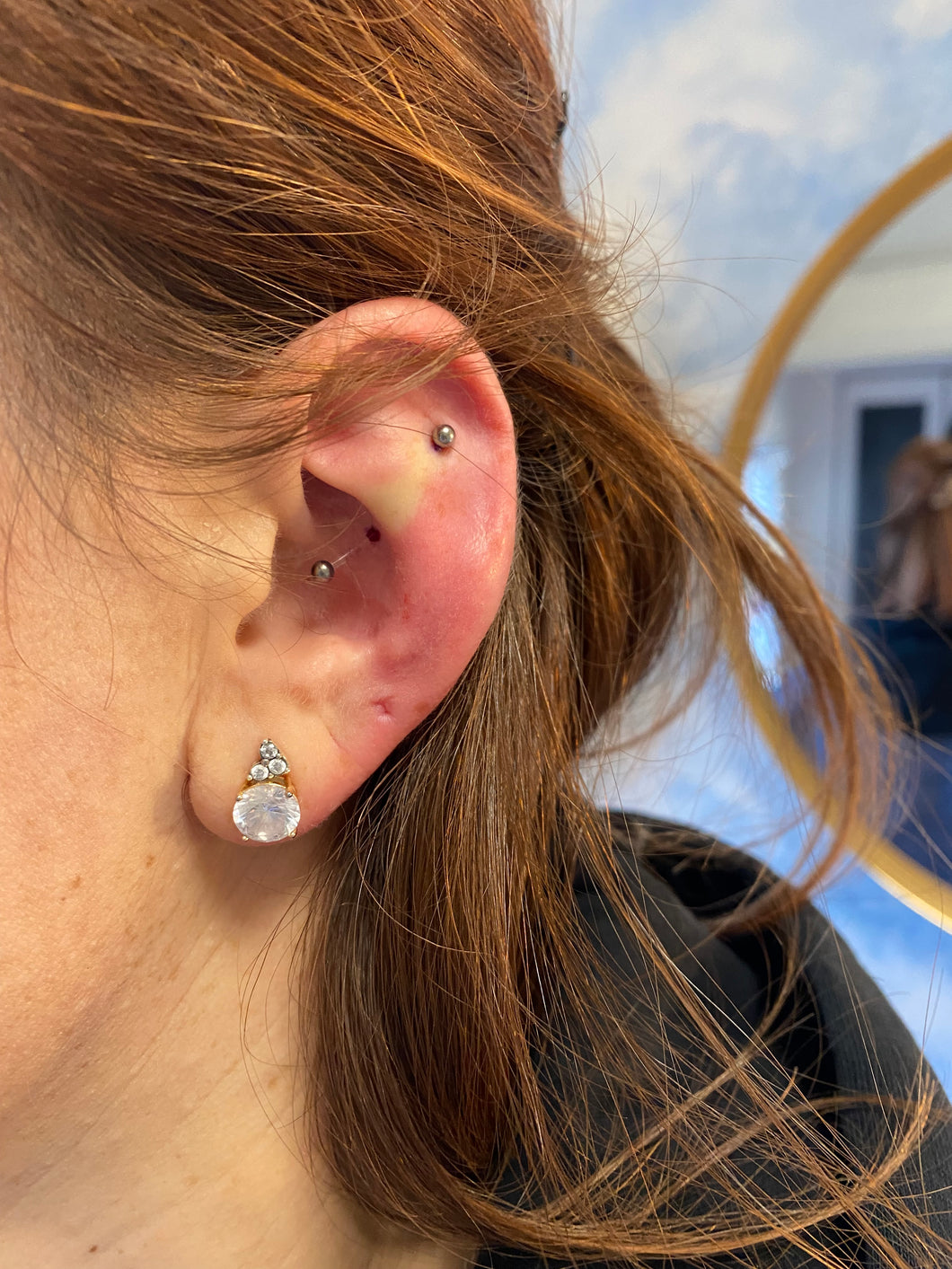 Ear pinning back