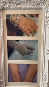 Hand Dermals