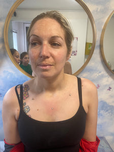 Dermals skin