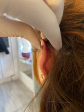 Load image into Gallery viewer, Ear pinning back
