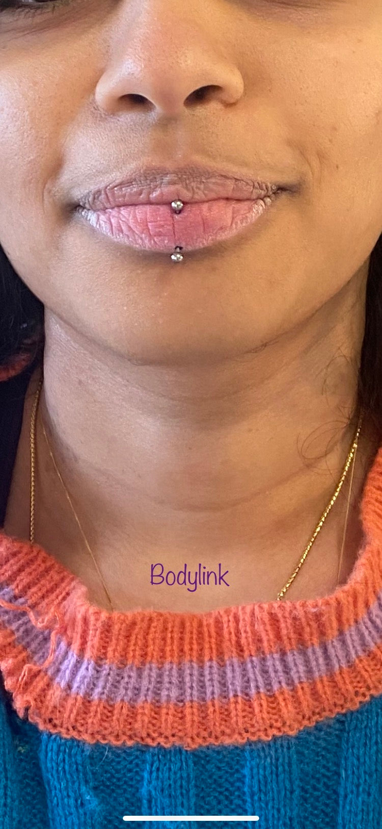 Vertical lip