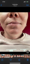 Load image into Gallery viewer, Lips before and after
